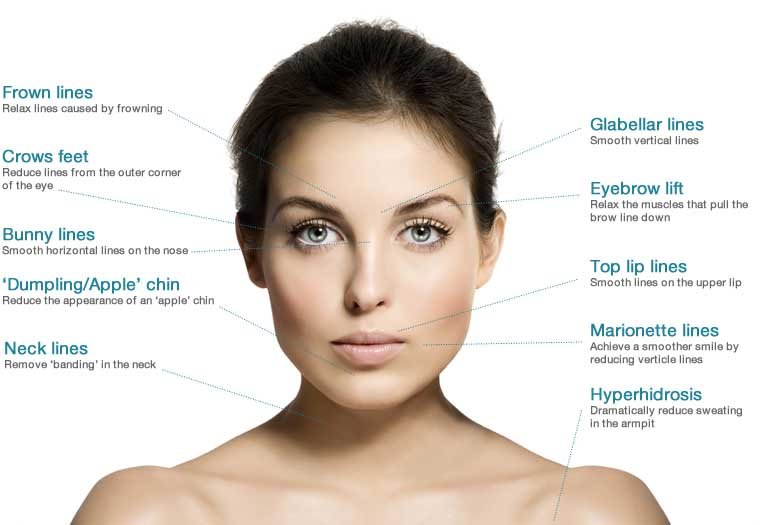 botox orange county california